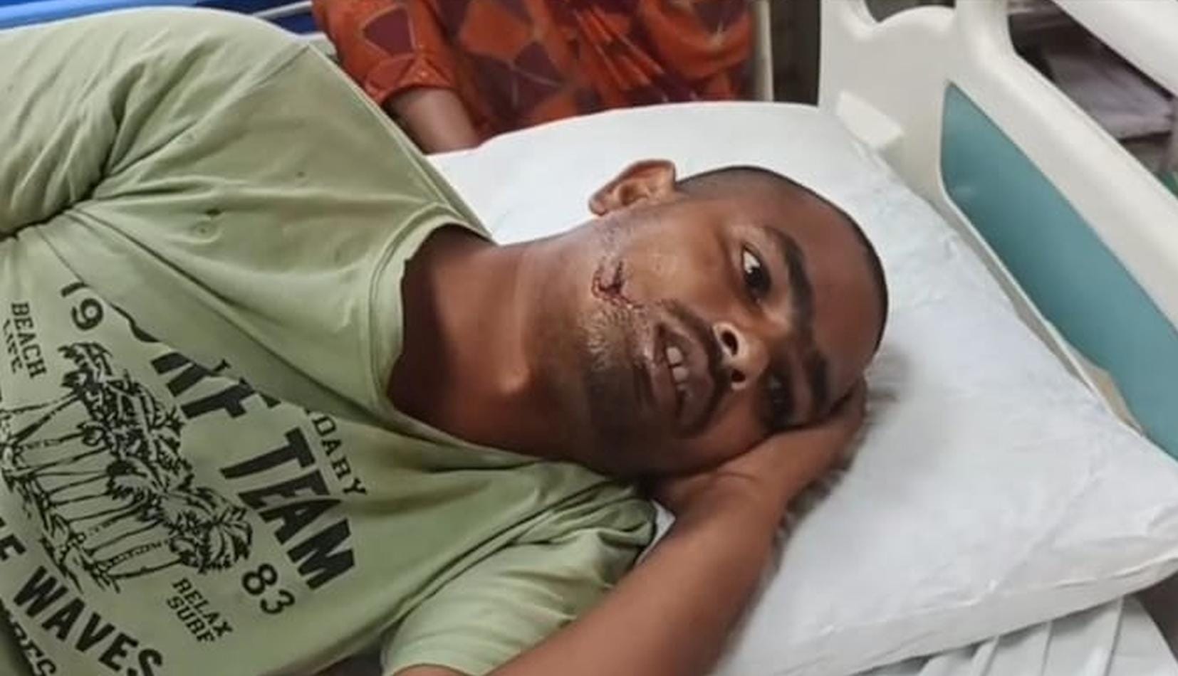 सियार के हमले में घायल किसान पिंटू।