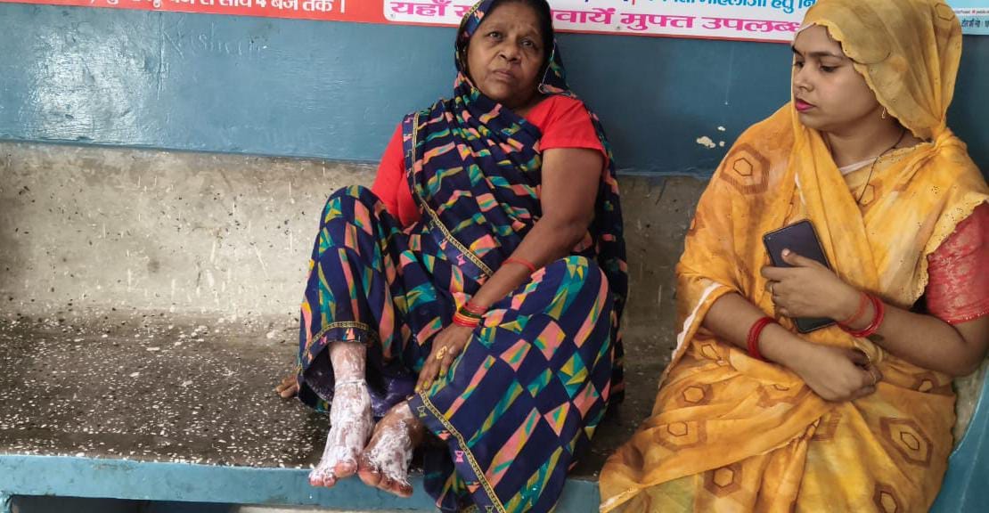 Boiling oil thrown at female shopkeeper for refusing to give samosas on credit; accused arrested.