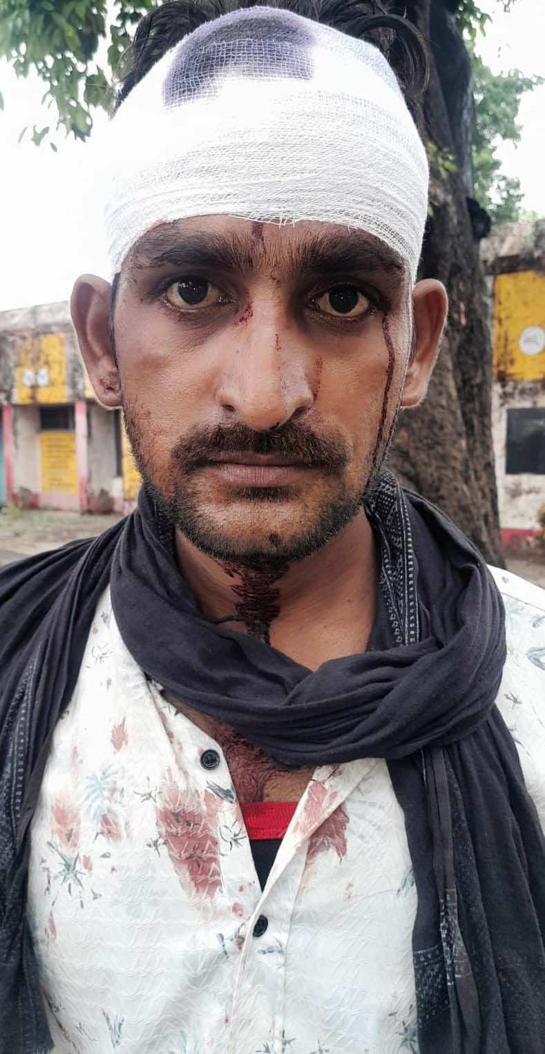 Three injured, including a watchman, in a scuffle.