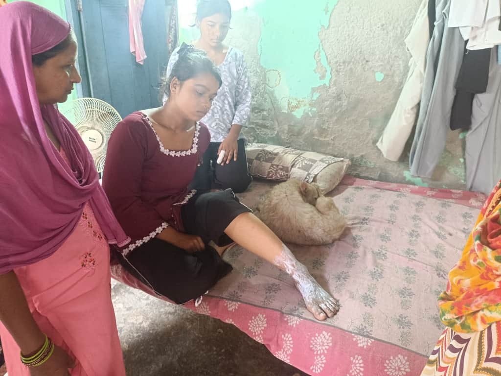 Fire breaks out due to gas cylinder leak; mother, son, daughter, and pet dog suffer burns.