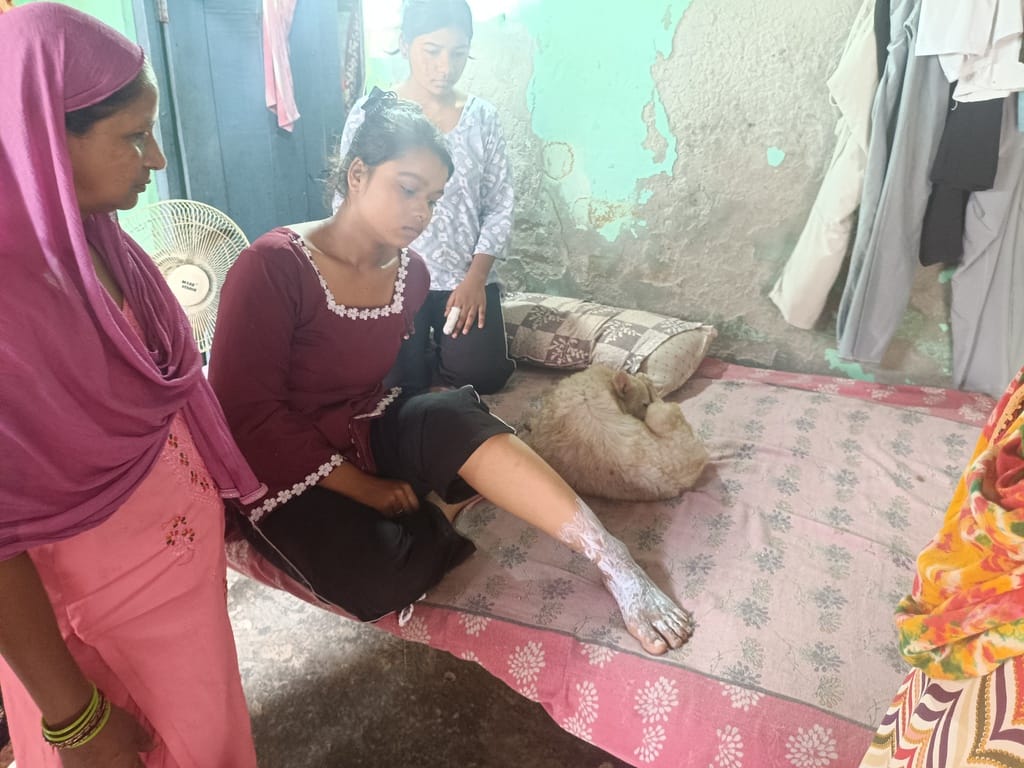 Fire breaks out due to gas cylinder leak; mother, son, daughter, and pet dog suffer burns.