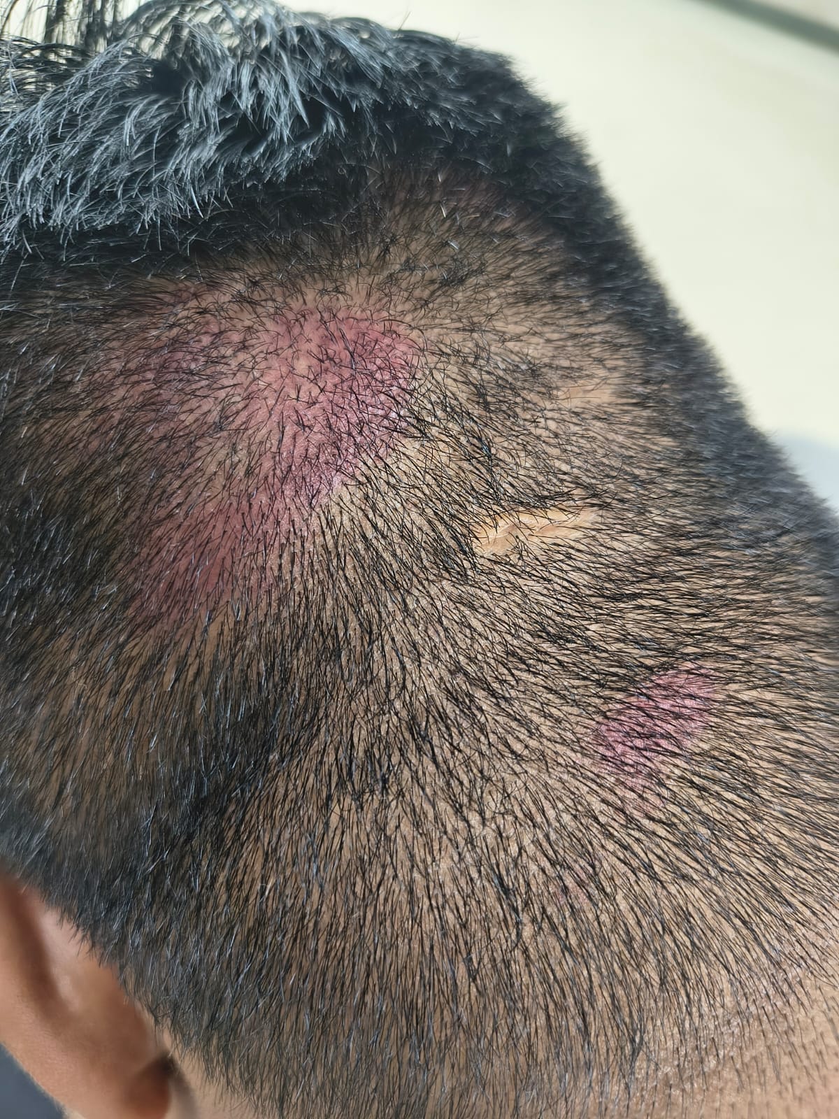 Youth attacked with intent to kill in Nindana; plea for justice.