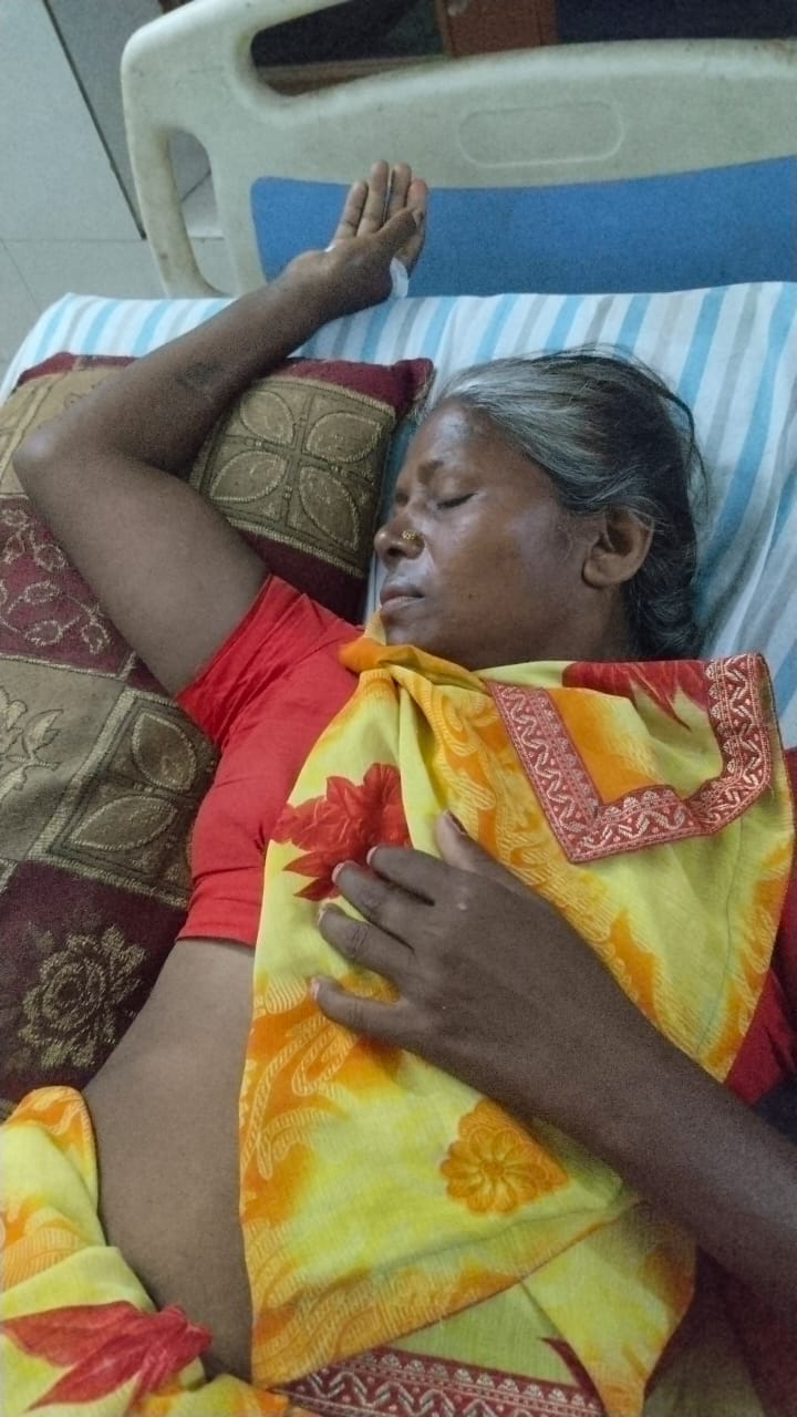 गैस सिलिंडर से भड़की आग से झुलसी रसोईया निजी अस्पताल में भर्ती। संवाद