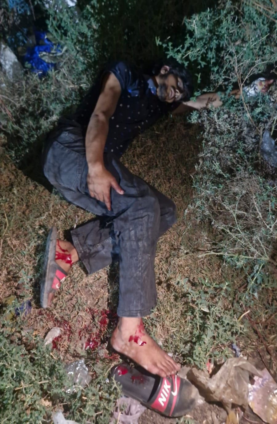 Gaurav turned into a monster the moment he was punched; inflicted 17 blows with a Swiss knife