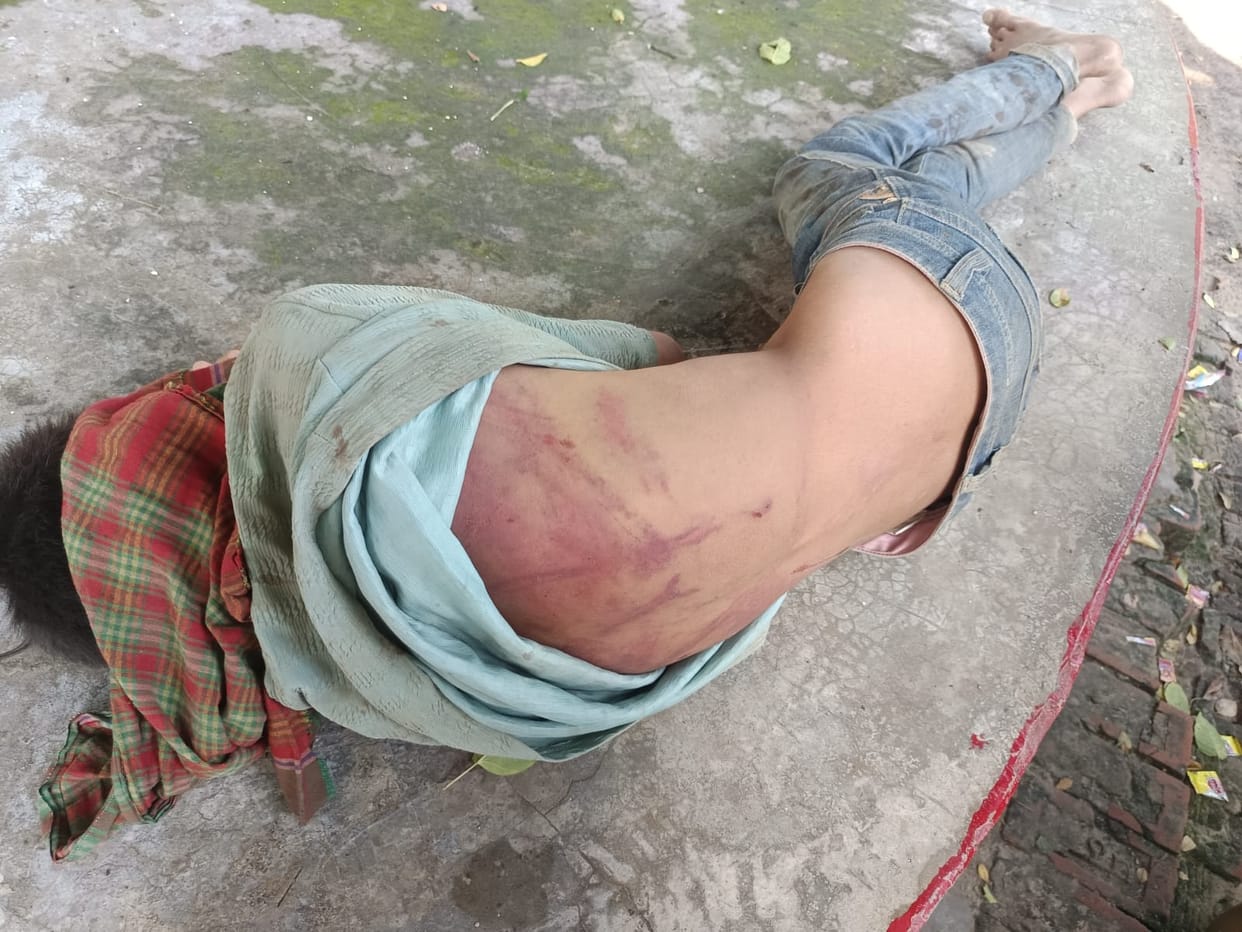 Beat the boy after taking him hostage, burned him with a cigarette
