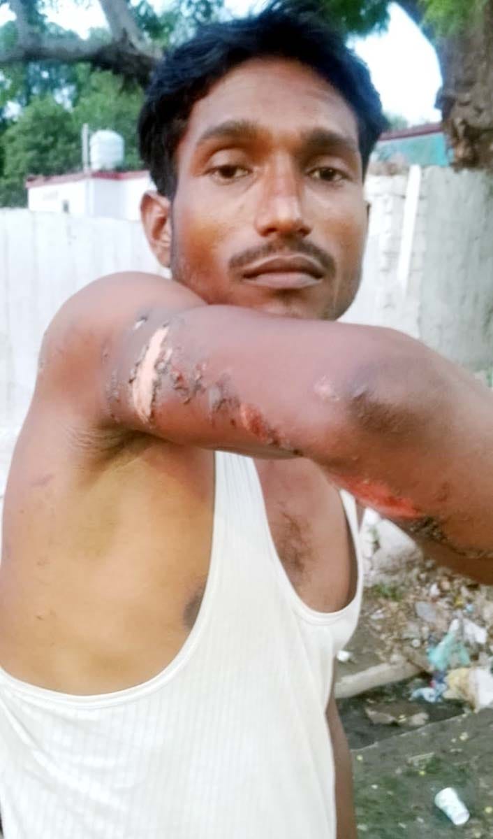 Attempt to burn a young man to death over a land dispute