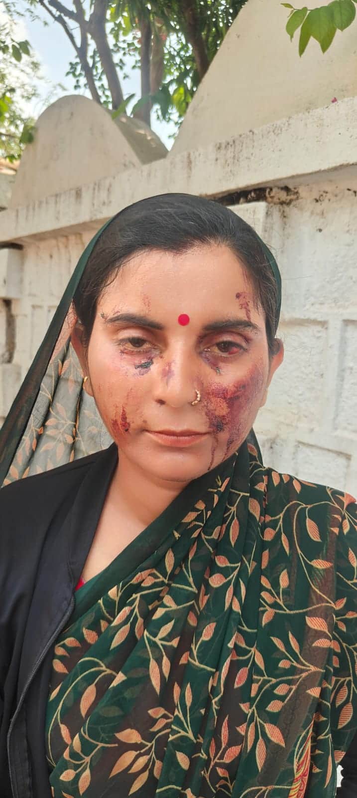 खून से लथपथ महिला एसपी ऑफिस पहुंची