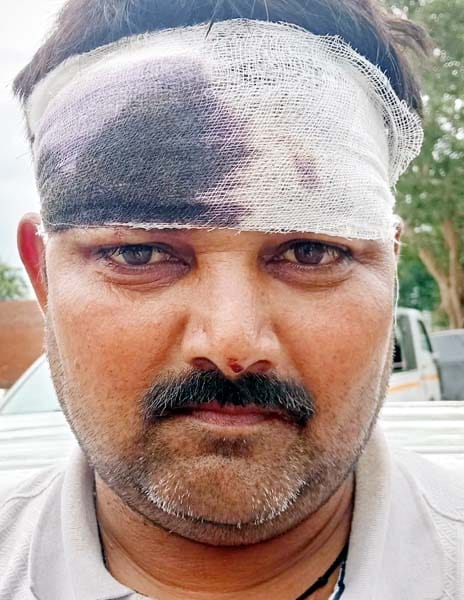 Langur seriously injures former councilor.