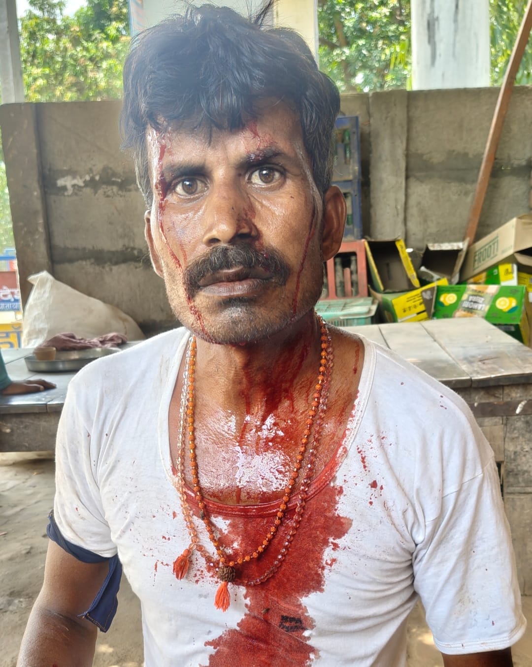 Son beats father bloody in domestic dispute