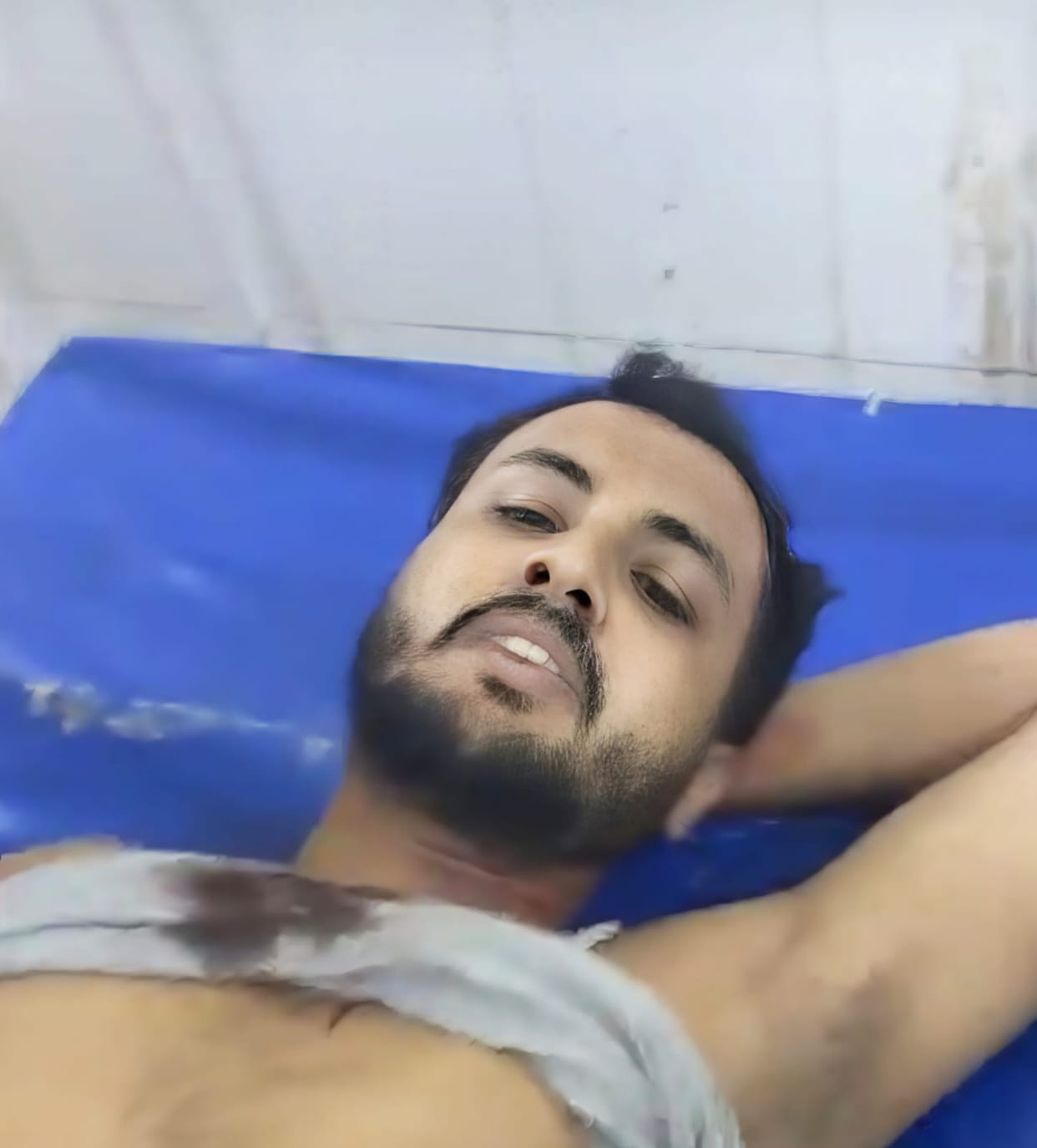Firing over old enmity; youth shot in the abdomen.