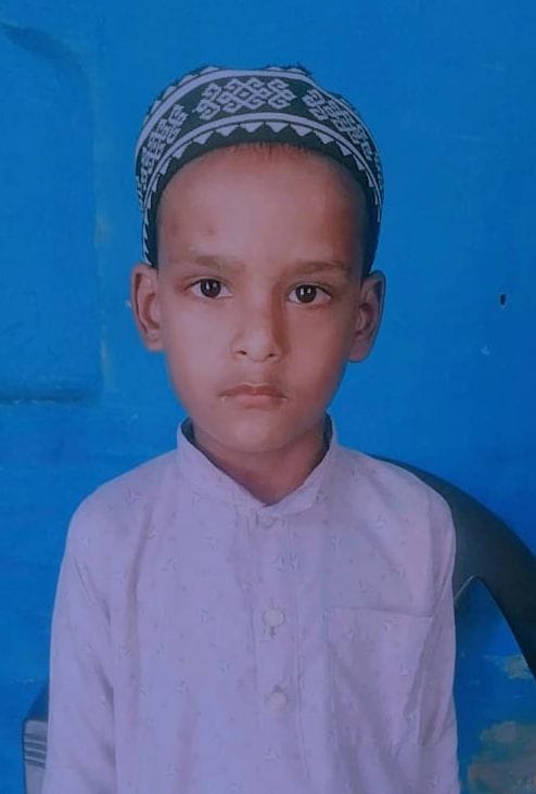 Nine-year-old child dies a month after dog bite; allegations of negligence in treatment.
