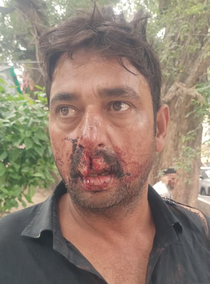 Stone-pelting between two groups following an altercation; four injured.