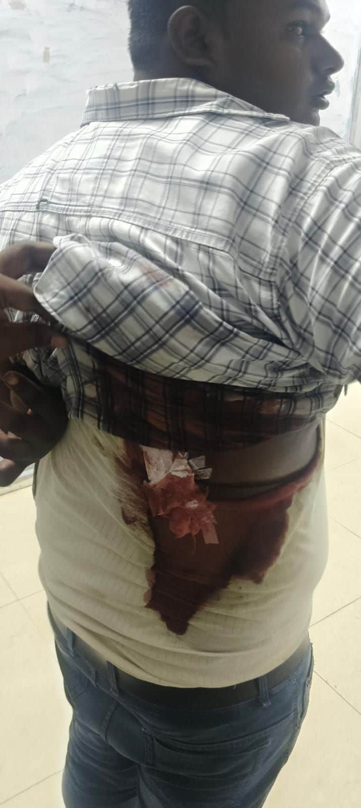 Youth accused of attack stemming from a feud; police express skepticism over claims of gunfire.