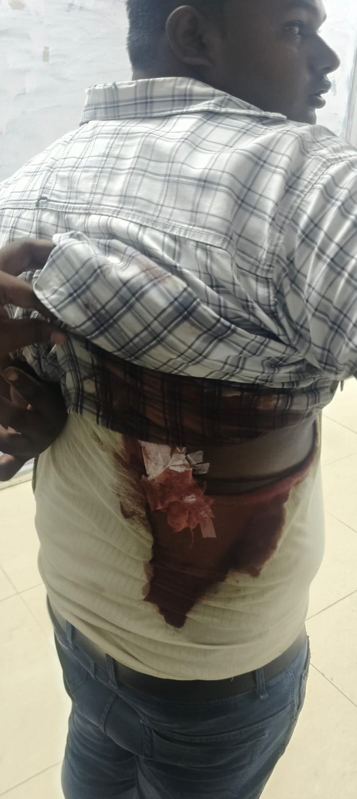 Youth accused of attack stemming from a feud; police express skepticism over claims of gunfire.