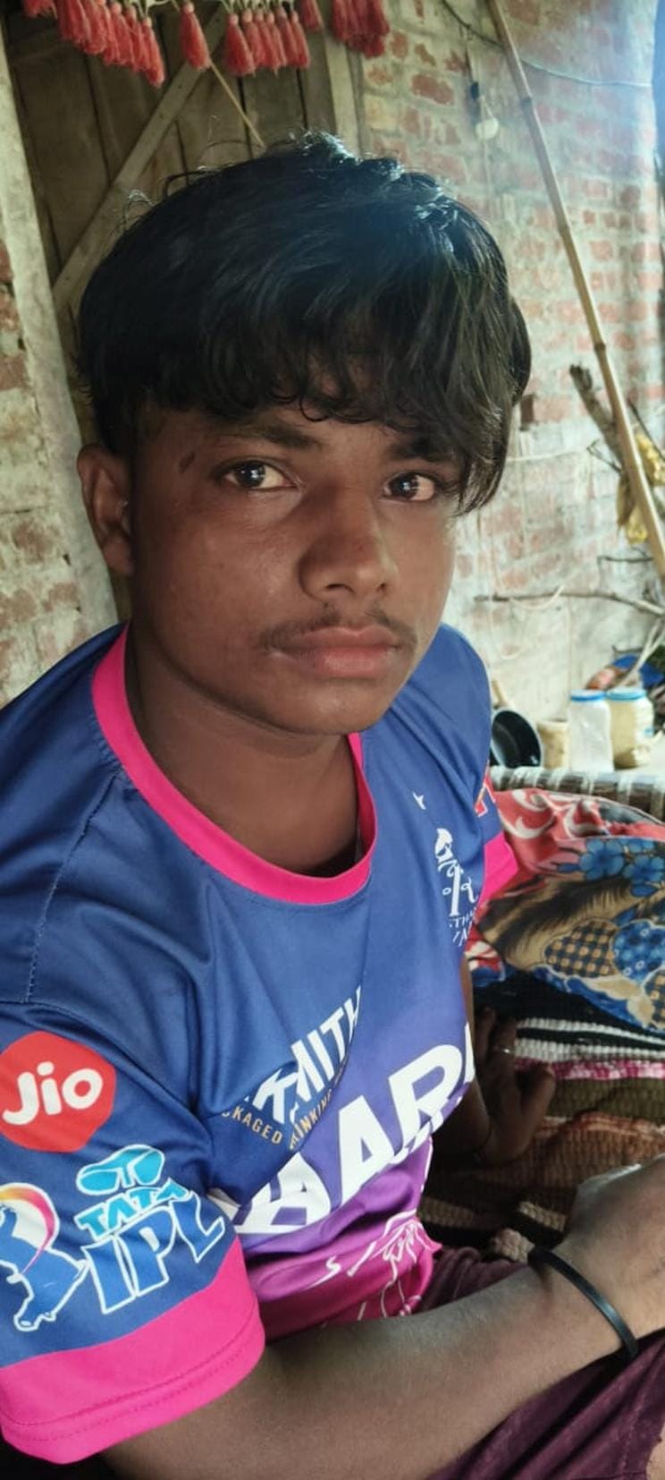 निशानगाड़ा रेंज के कुटिया रमपुरवा गांव में तेंदुए के हमले में घायल धर्मेंद्र।