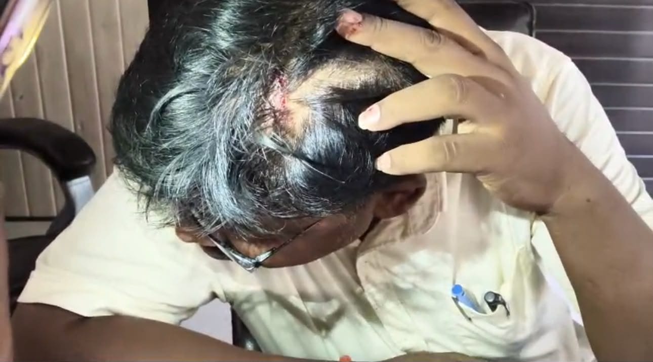 पत्थर से घायल हुए नायब तहसीलदार