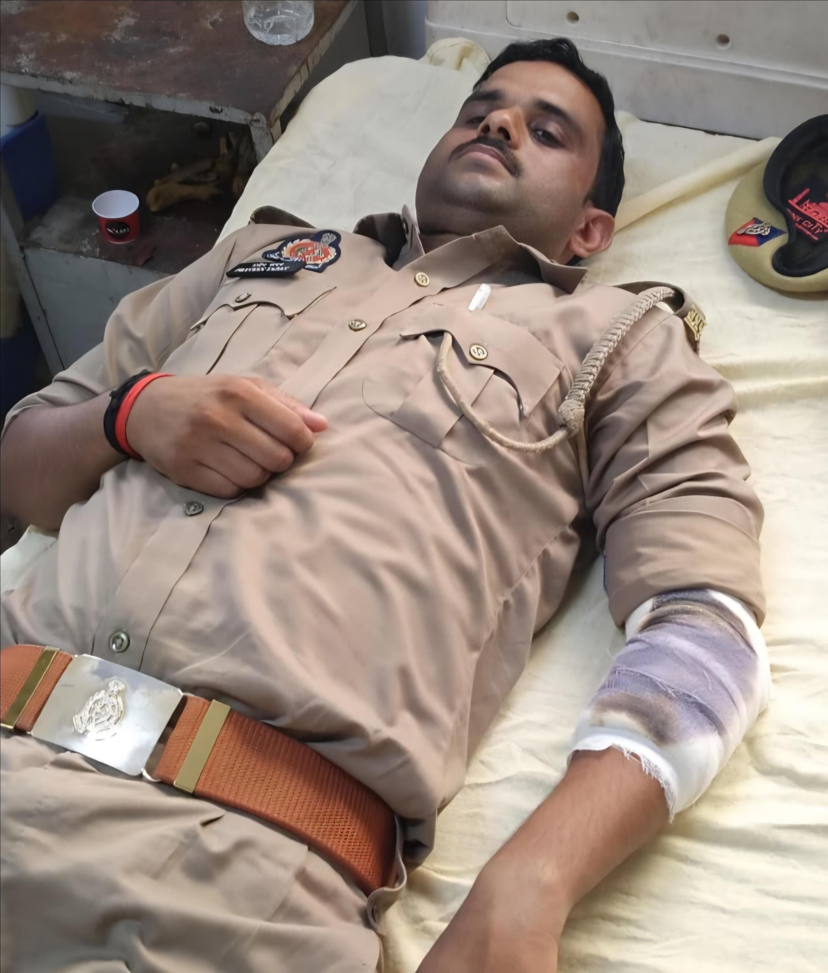 फोटो-3 सीएचसी कायमगंज में भर्ती घायल सिपाही प्रवीण कुमार। संवाद