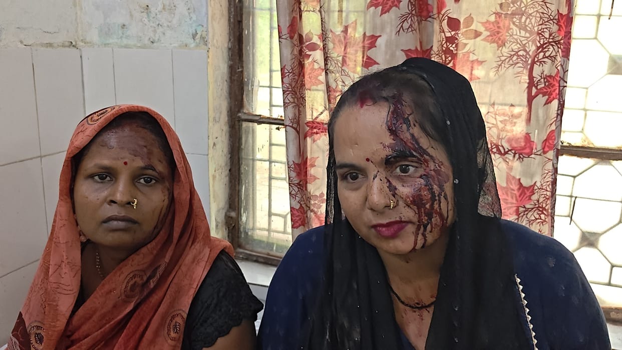 In-laws attack mother, brother and sisters-in-law with a shovel, 4 injured