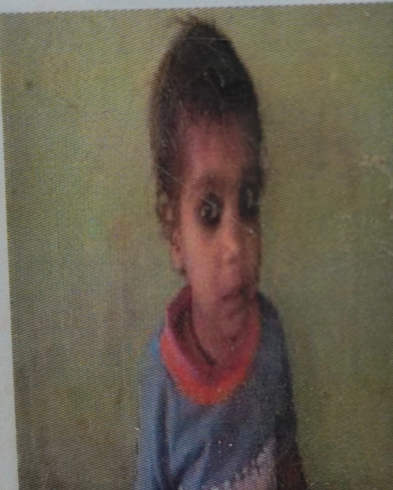 Anganwadi student dies after being hit by a motorcycle.