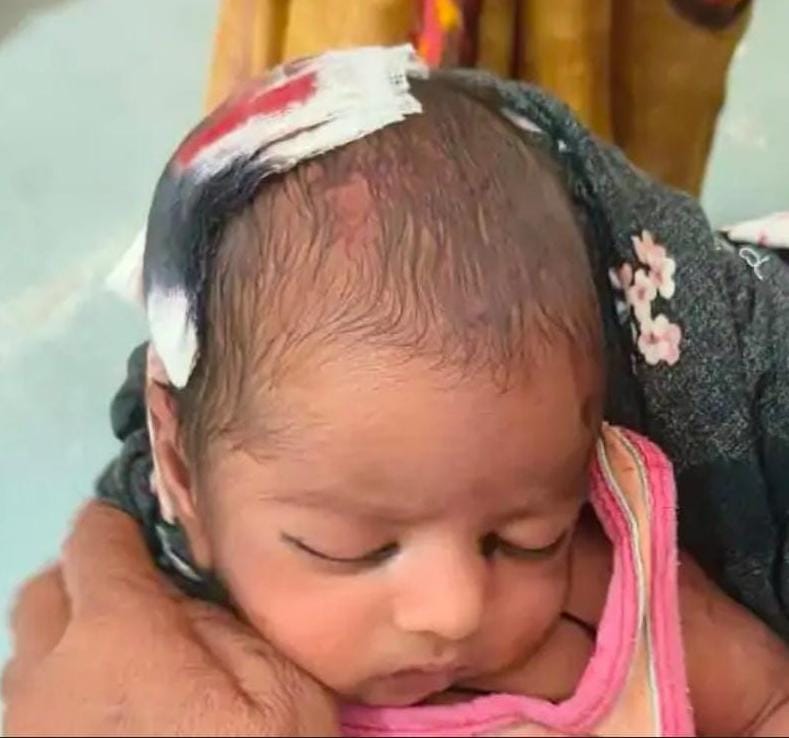 घायल पार्थ। संवाद