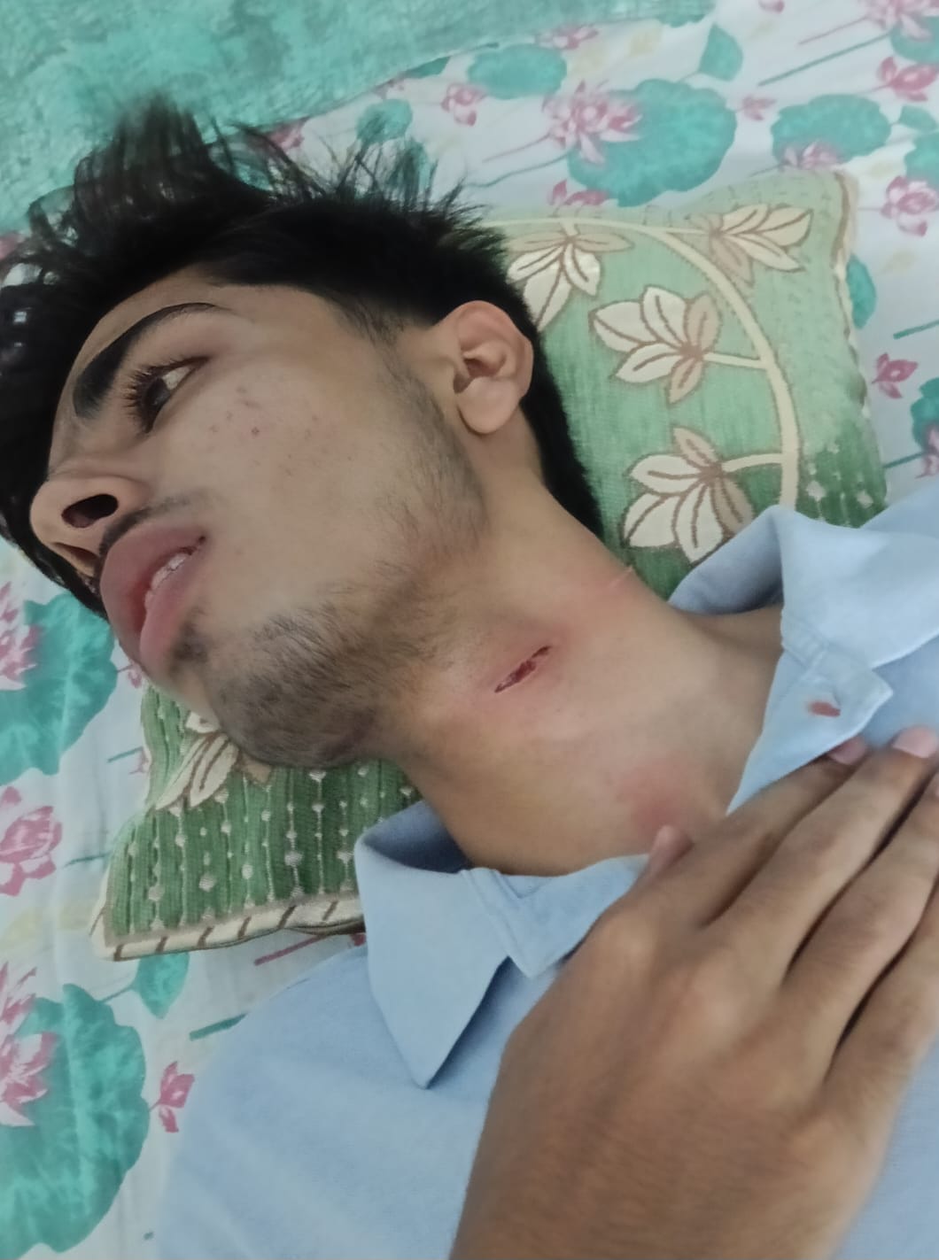 Teen's neck slit with banned manjha