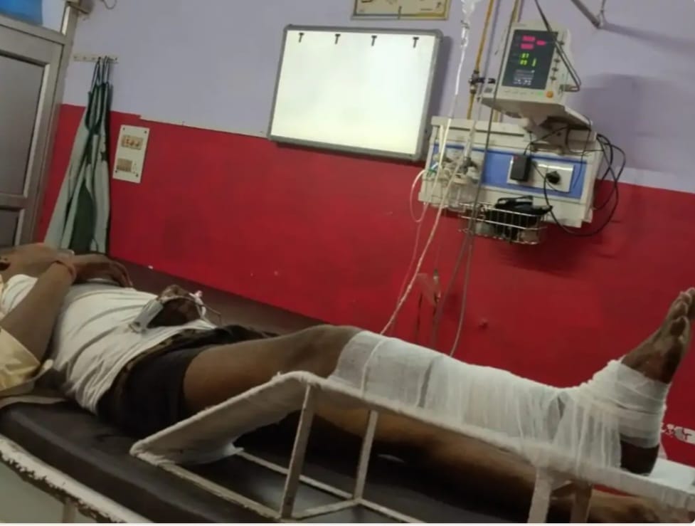 थानागद्दी, ऑटो चालक से मारपीट कर तोड़ा पैर, ऑटो रिक्शा लूटकर फरार। स्रोत-संवाद