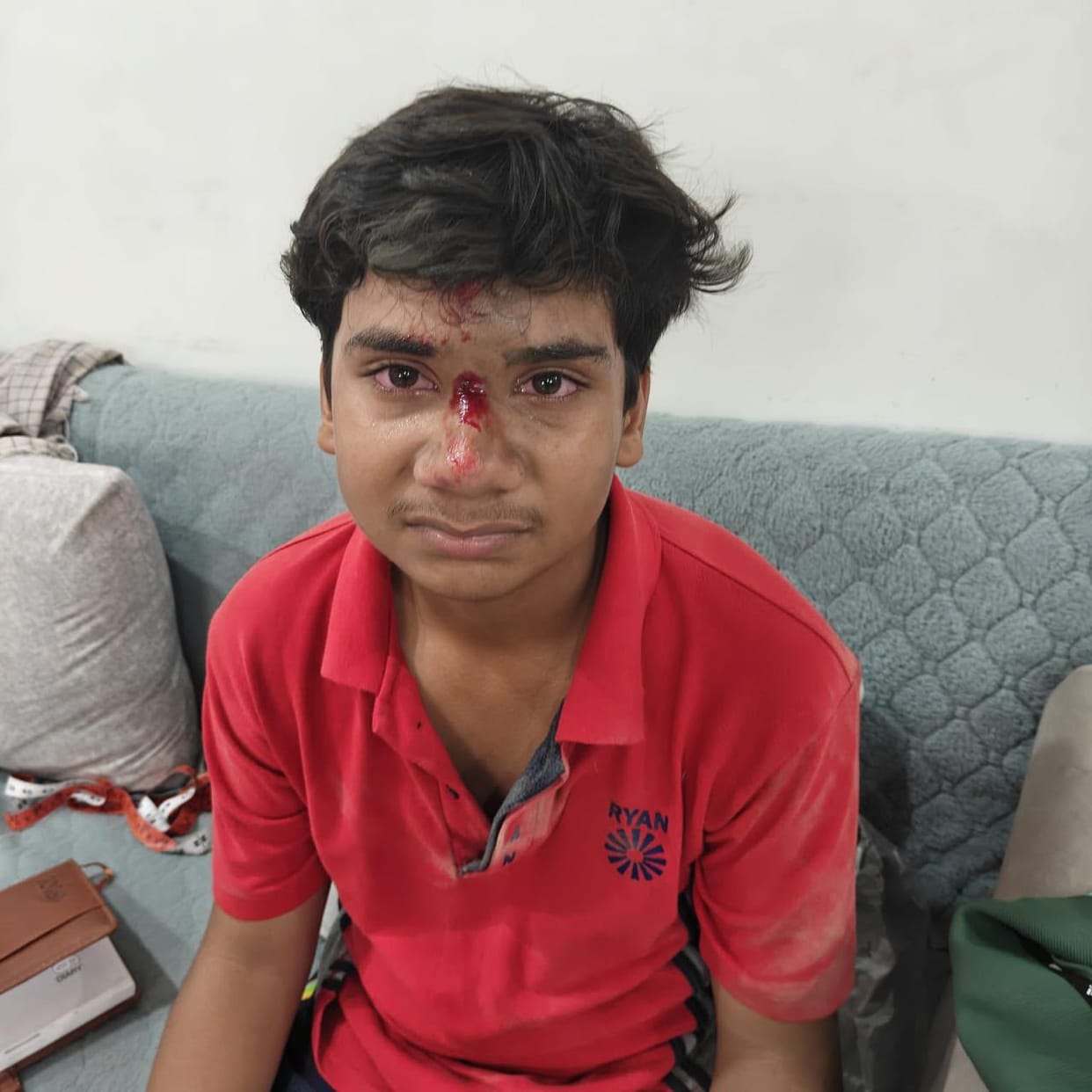Youth injured in monkey attack in Sector-1