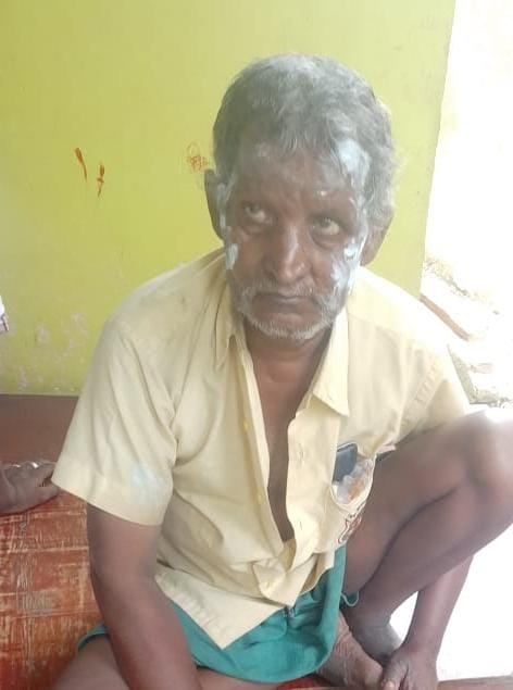 झुलसा भगवान दीन का चेहरा । संवाद