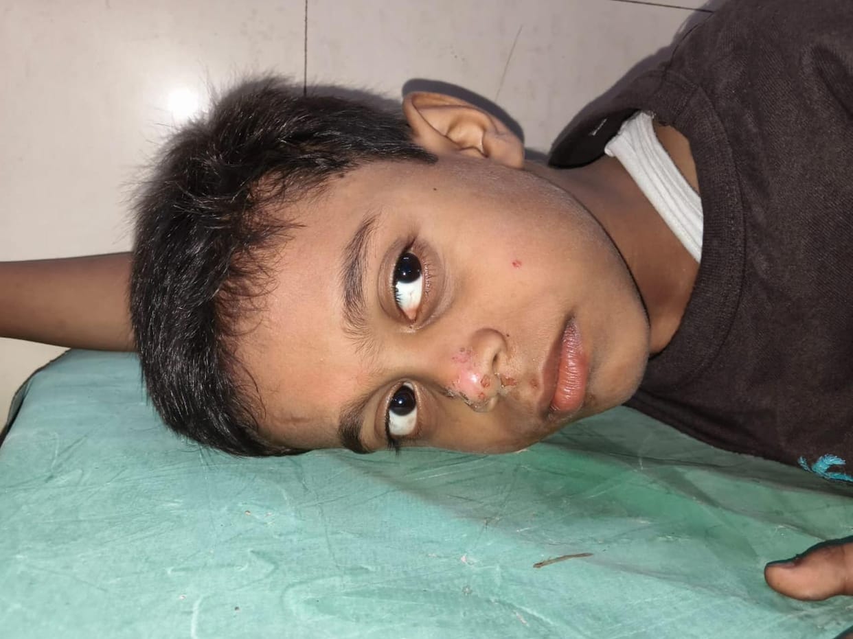 A dog injured a boy, and a jackal injured a woman.