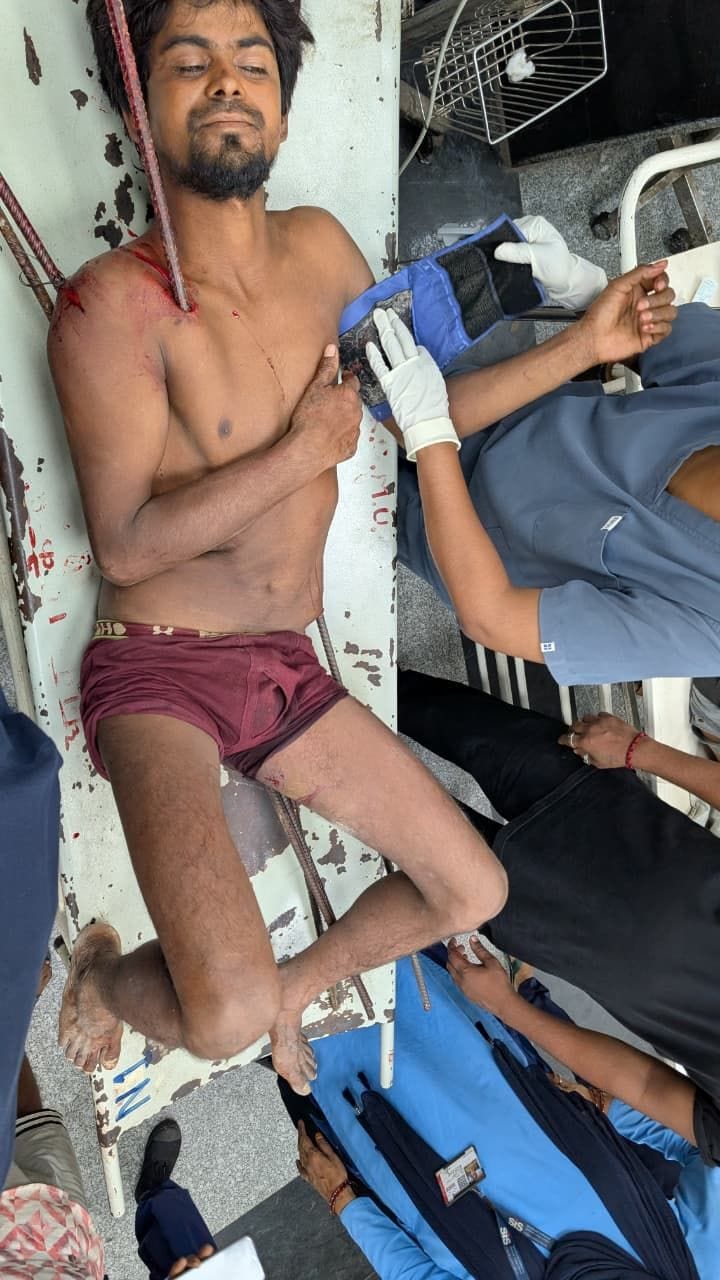 केजीएमयू में भर्ती घायल उमेश। 