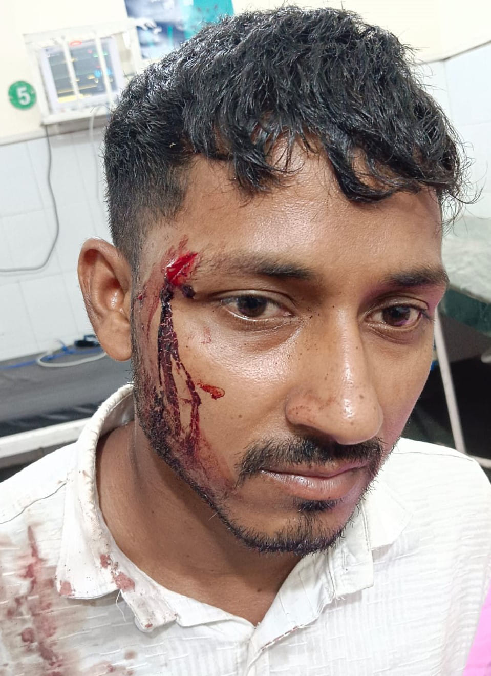 AGRA NEWS PERSON CATCHED GLASS BOTTLE ATTACK