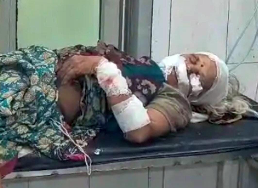 Woman injured in dog attack