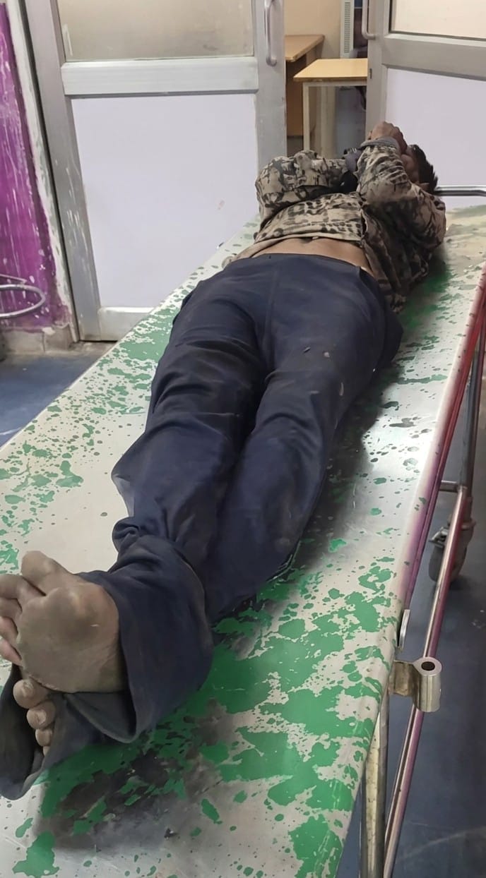 Young man's behavior changed after a dog bite; he bit several people, and neighbors tied his hands and feet to take him to the hospital.
