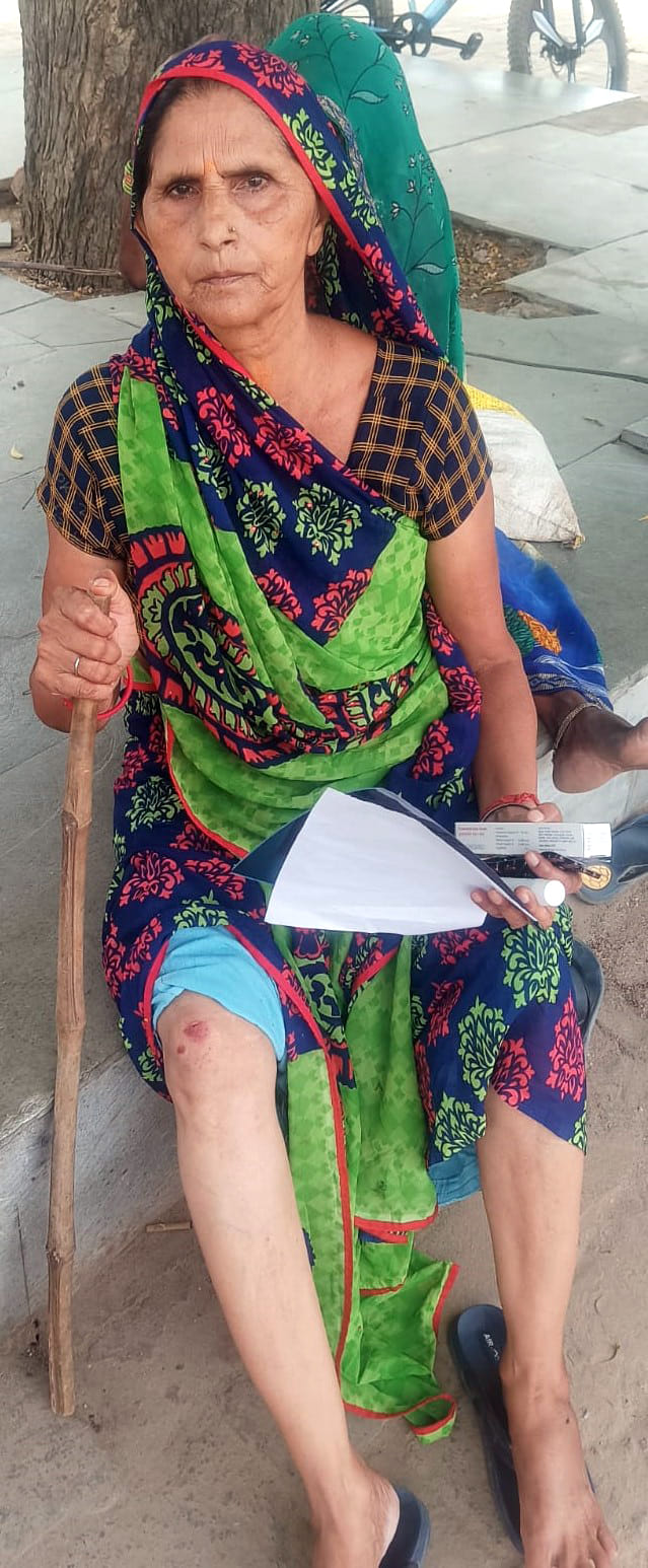 An elderly woman was injured after falling from a wall and being attacked by a group of monkeys.