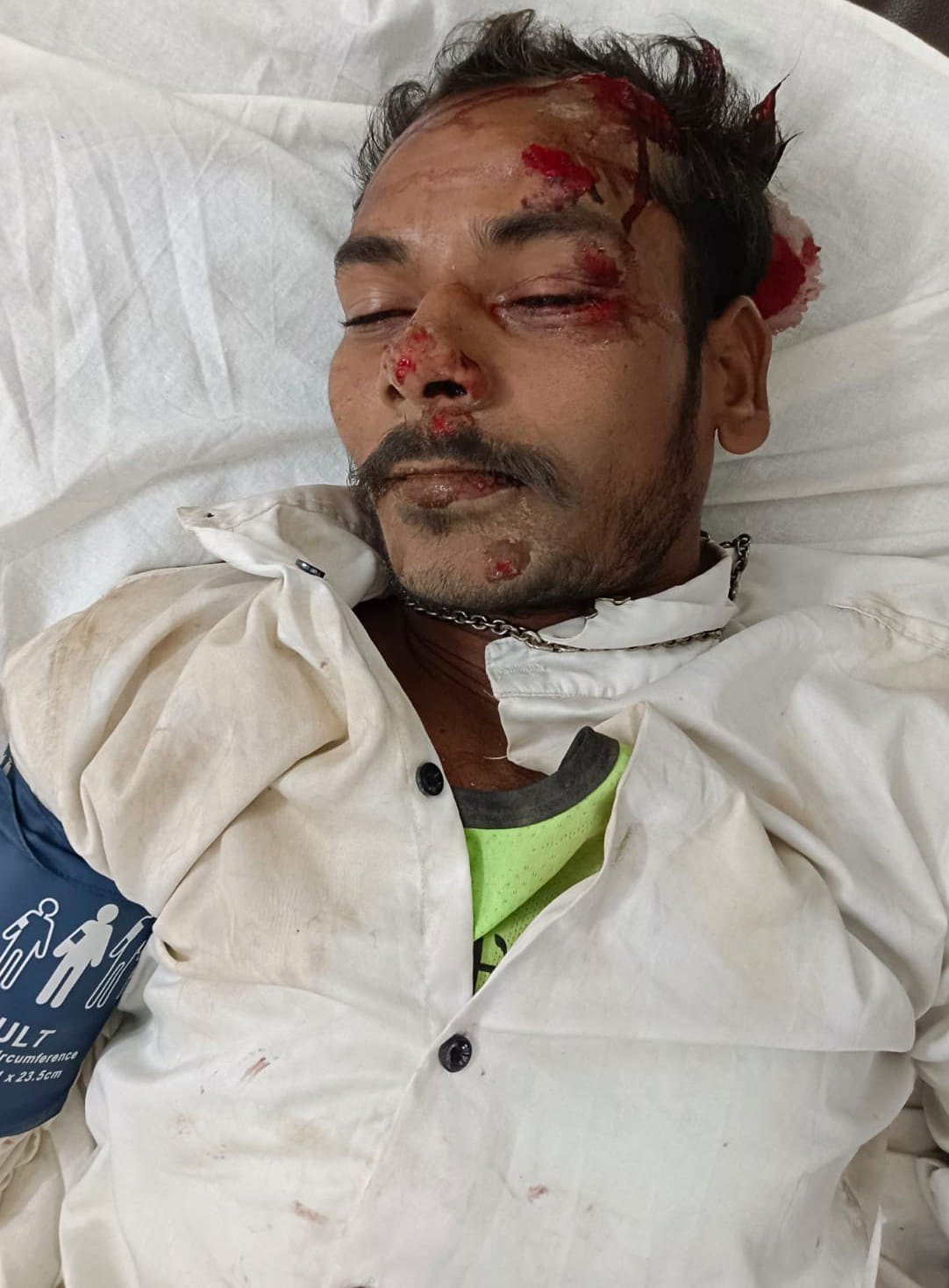 Bike rider injured after being hit by a bull