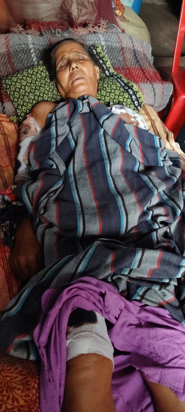 Stray dogs attack woman in Kithauli; she is injured.