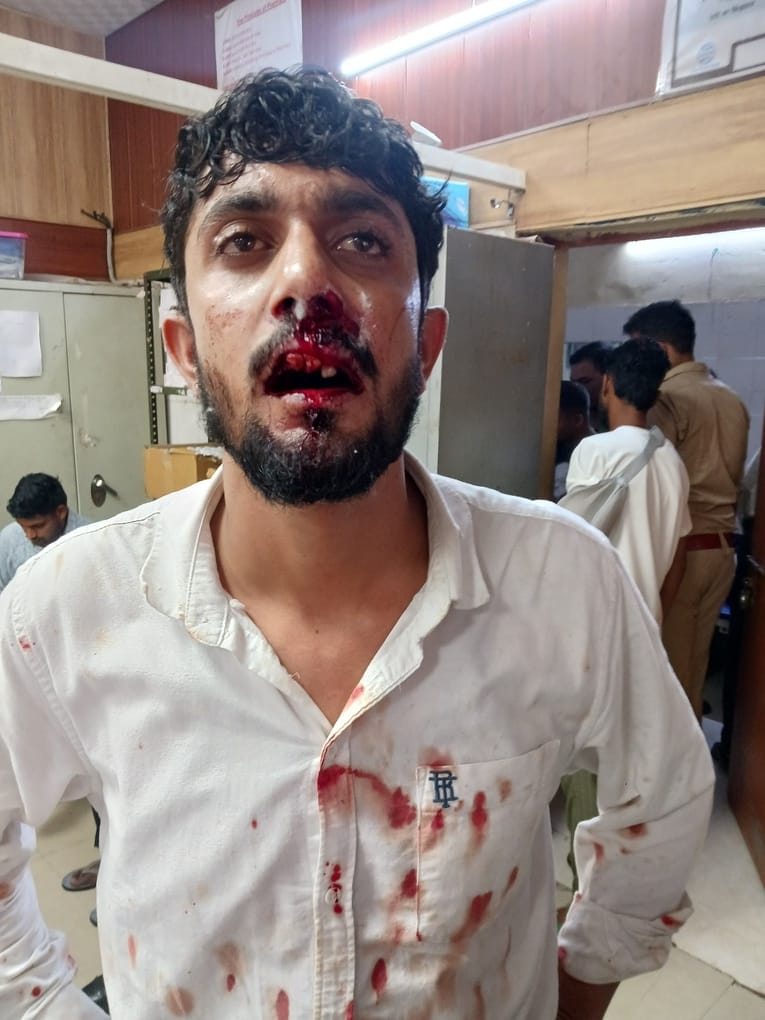 Firing on highway; bullet lodged in youth's jaw.