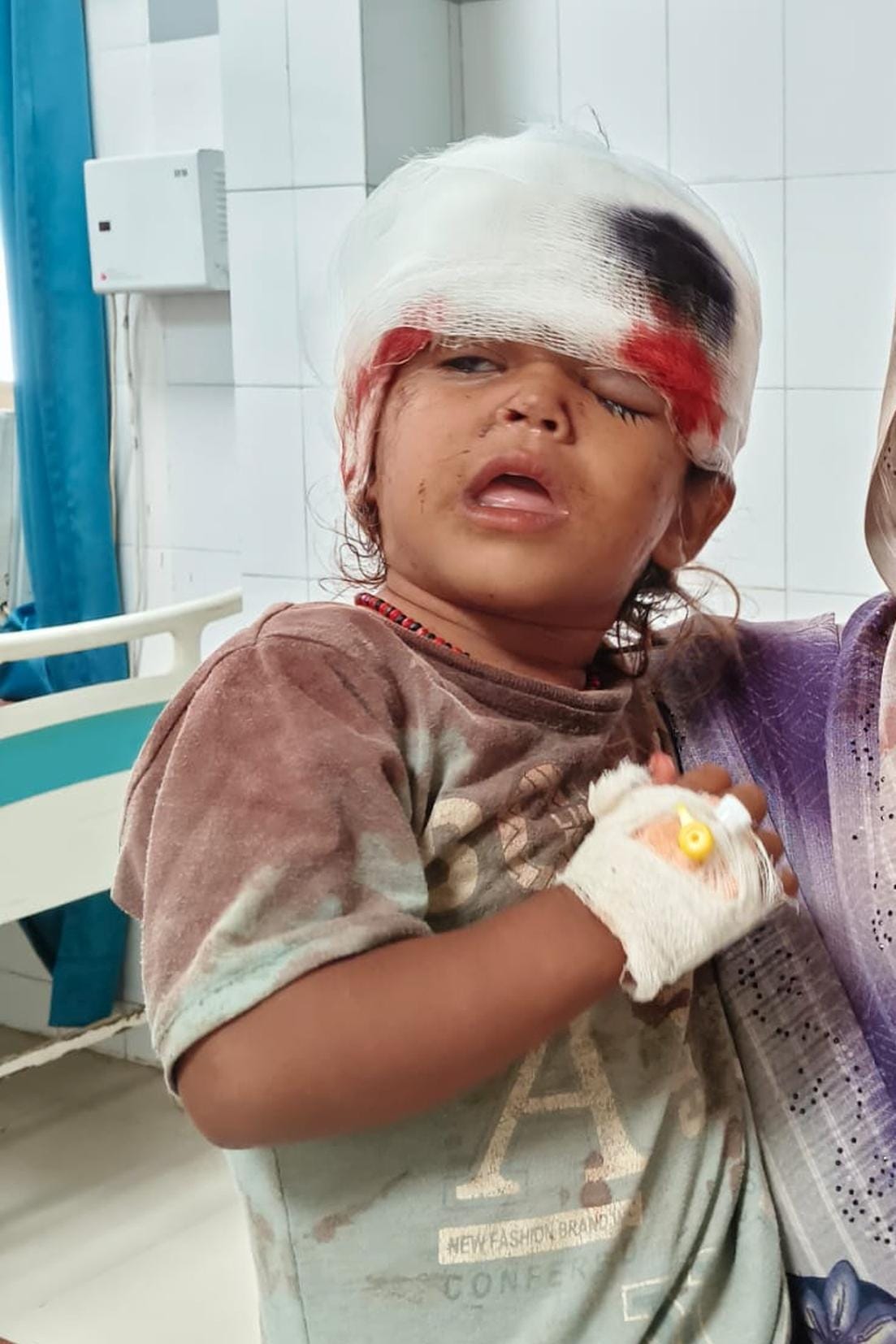 Two-year-old girl injured in dog attack