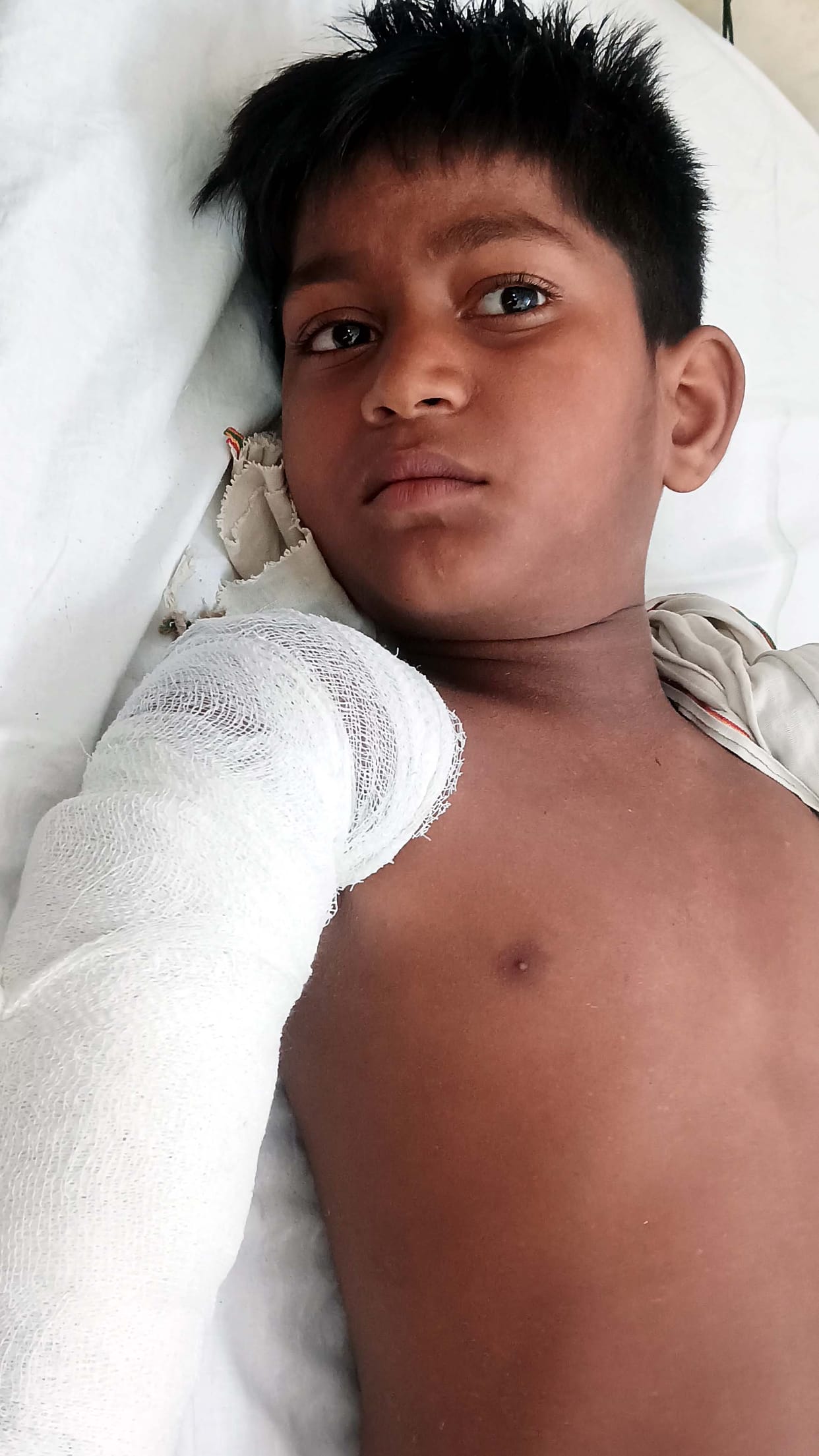 Student plucking berries falls from tree, breaks arm