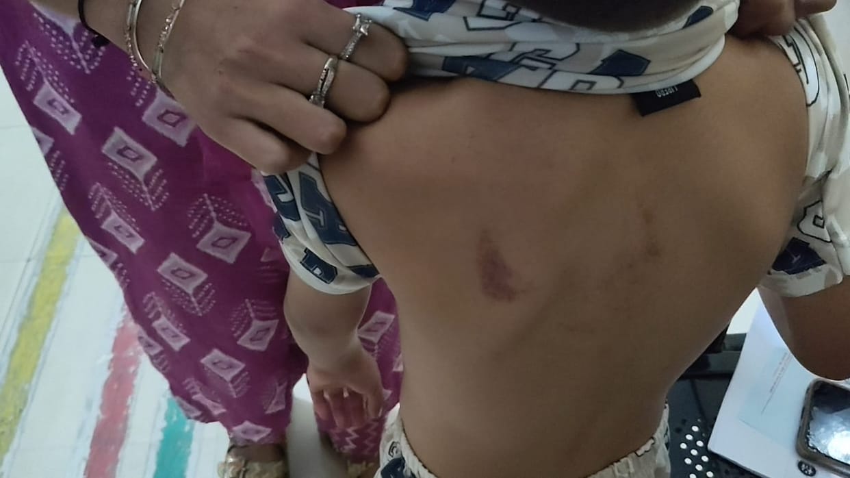 Wife of private school operator accused of beating five-year-old student.