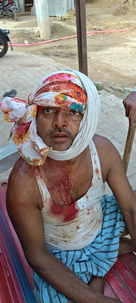 Brothers fight over return of gold collar, two injured