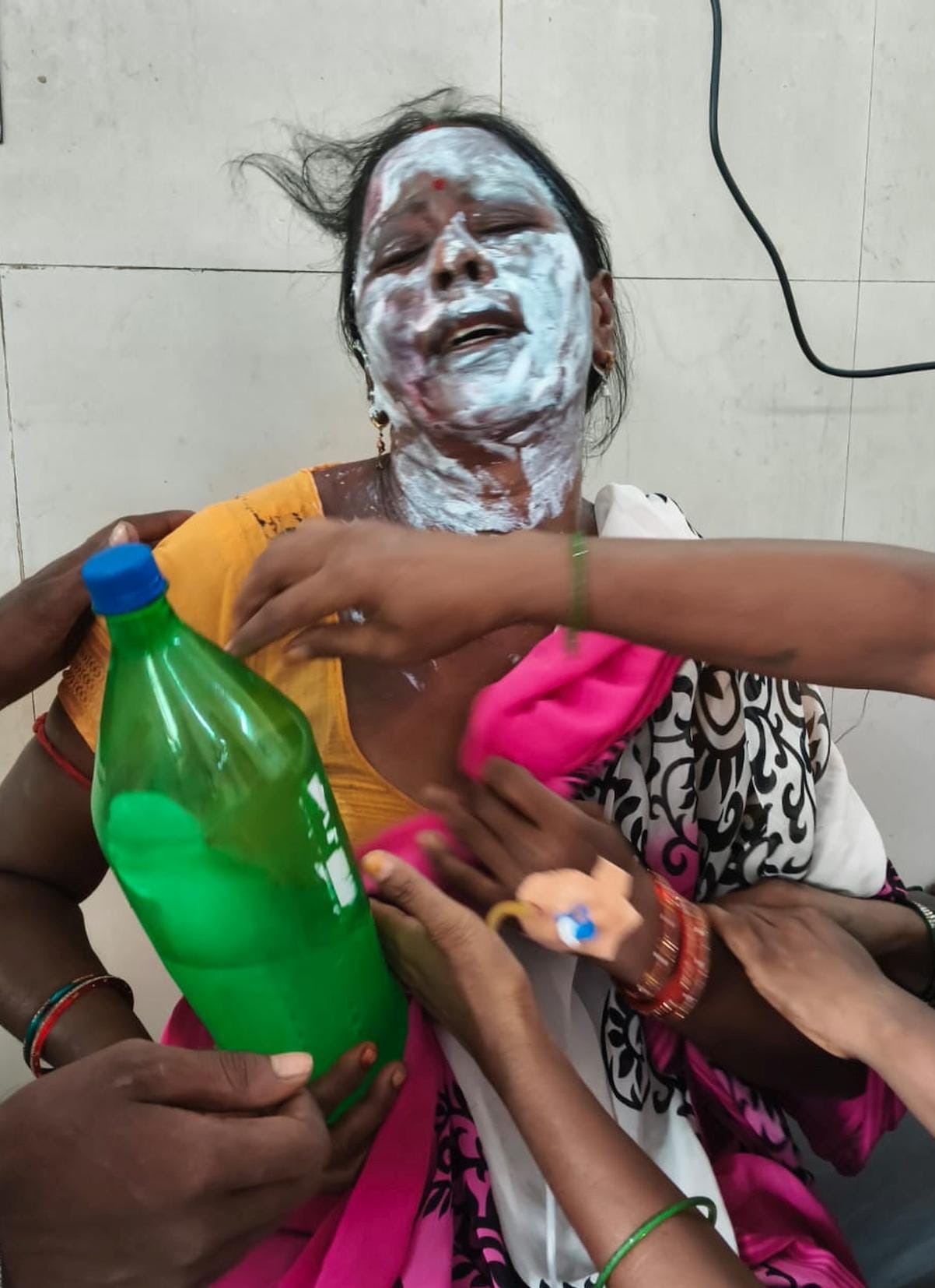 Cook suffers burns after fire breaks out due to gas pipe leakage while preparing midday meal.