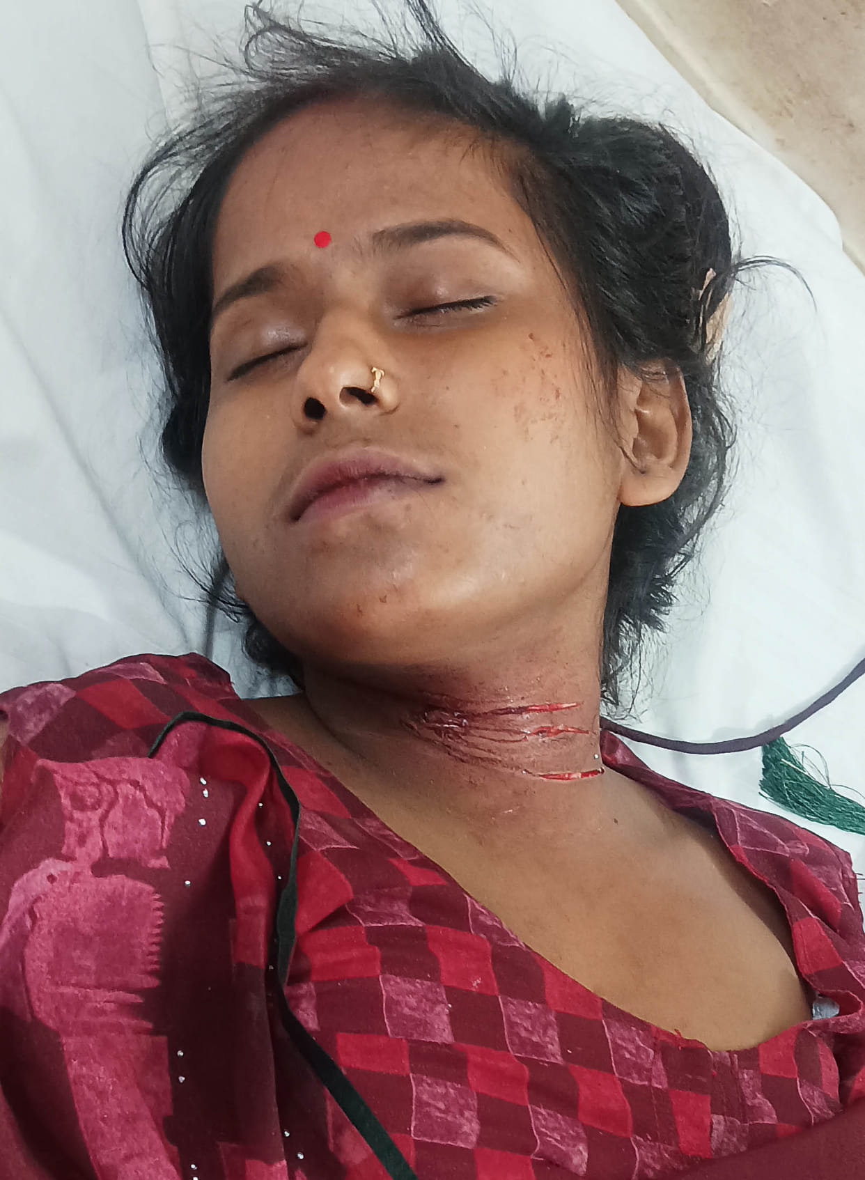 Woman's neck bleeding due to knife attack, admitted