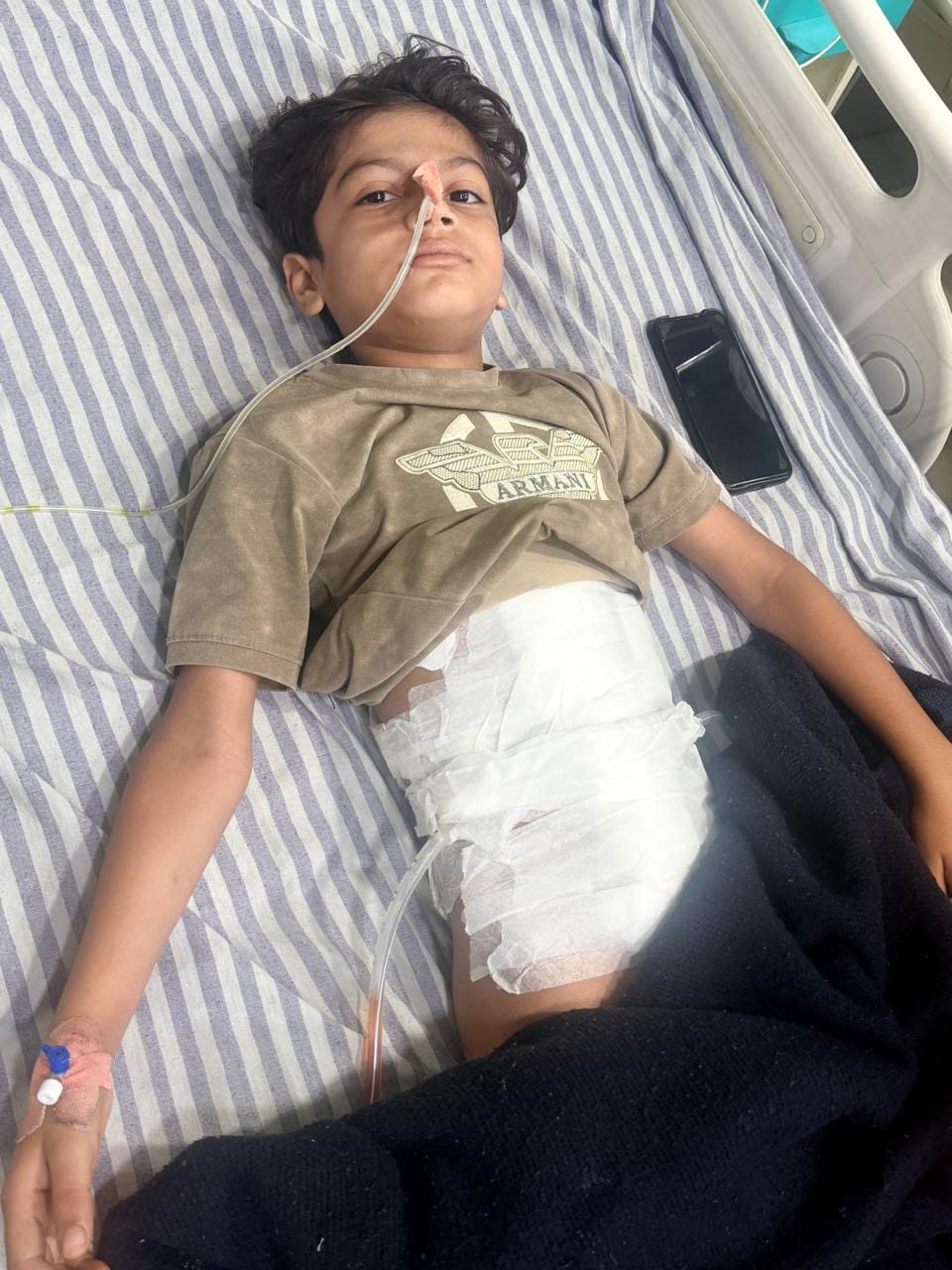 Child falls from roof while trying to escape monkey attack; critically injured.