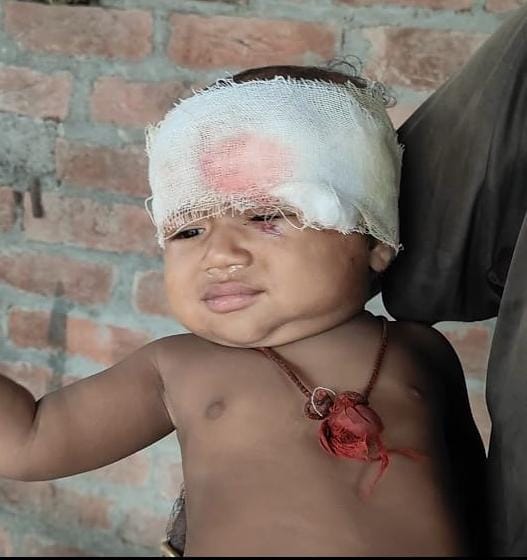 जंगली जानवर के हमले में घायल सिबका। संवाद