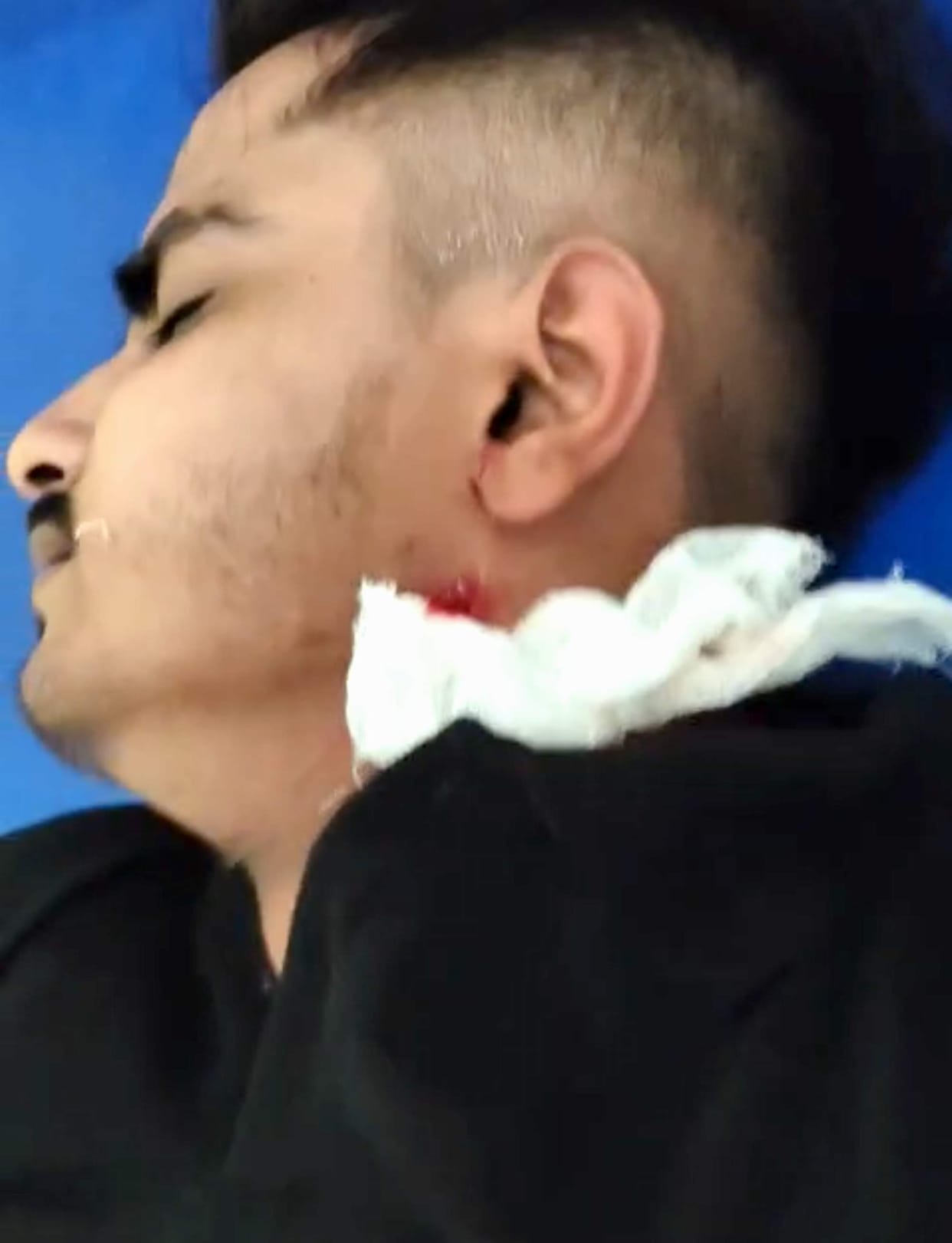 Young man attacked while visiting his brother; injured after being stabbed in the neck.