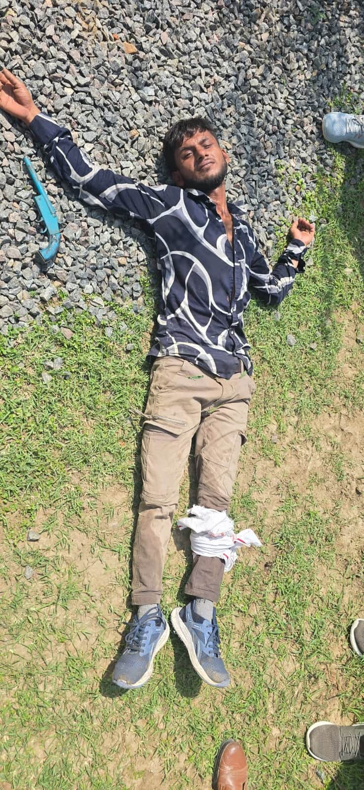 फोटो-15- पैर में गोली लगने से घायल एजाज। स्रोत-पुलिस।