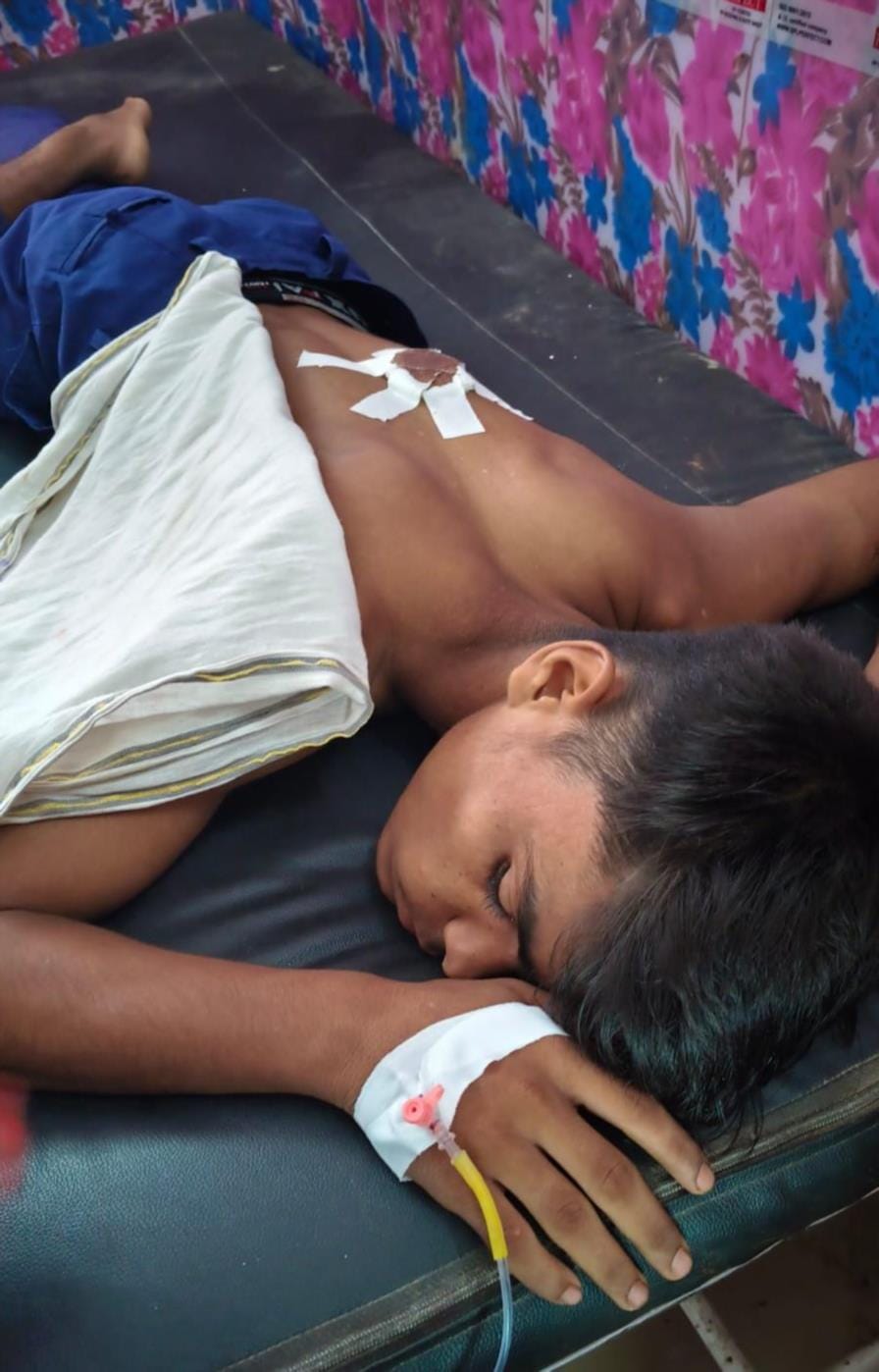 चाकू से हुए हमले में घायल 