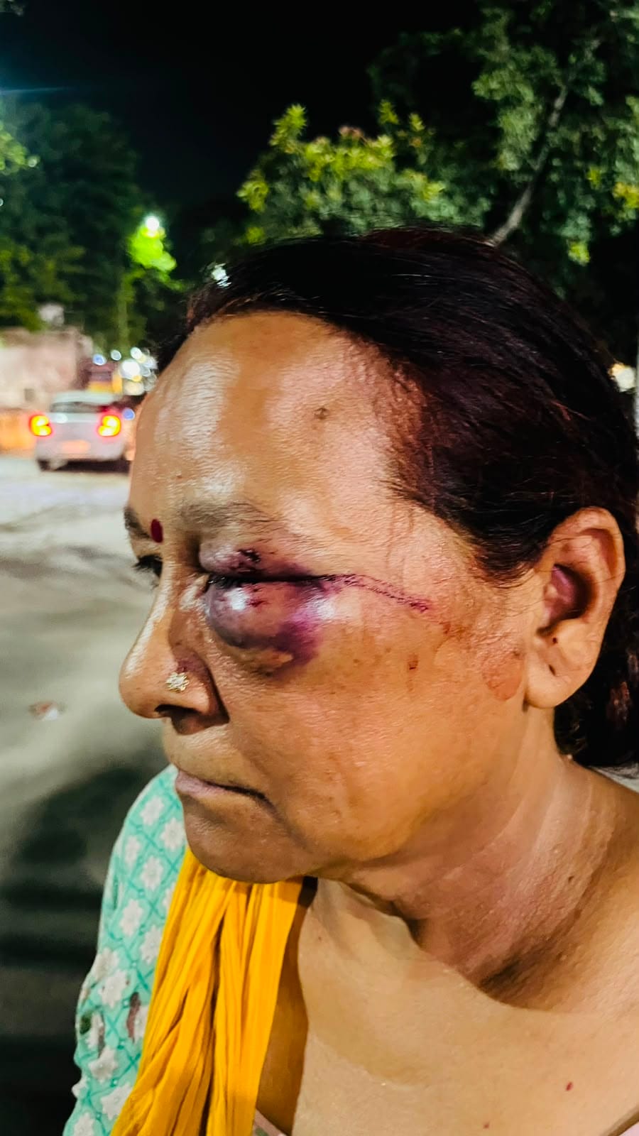 Couple, son, and daughter-in-law attacked after intruders barged into their home; woman sustains eye injury.