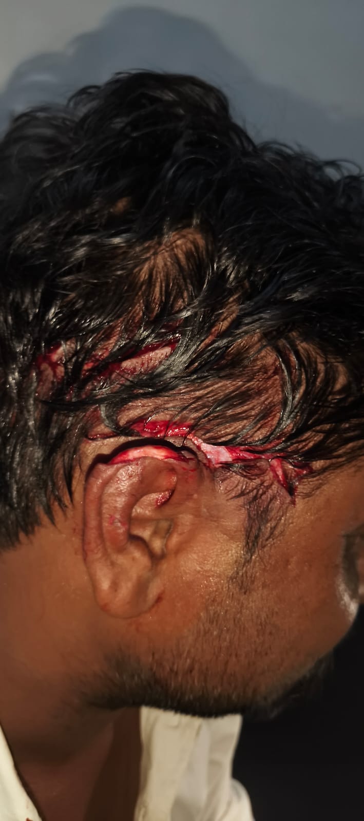 Driver injured in monkey attack, receives 10 stitches near ear